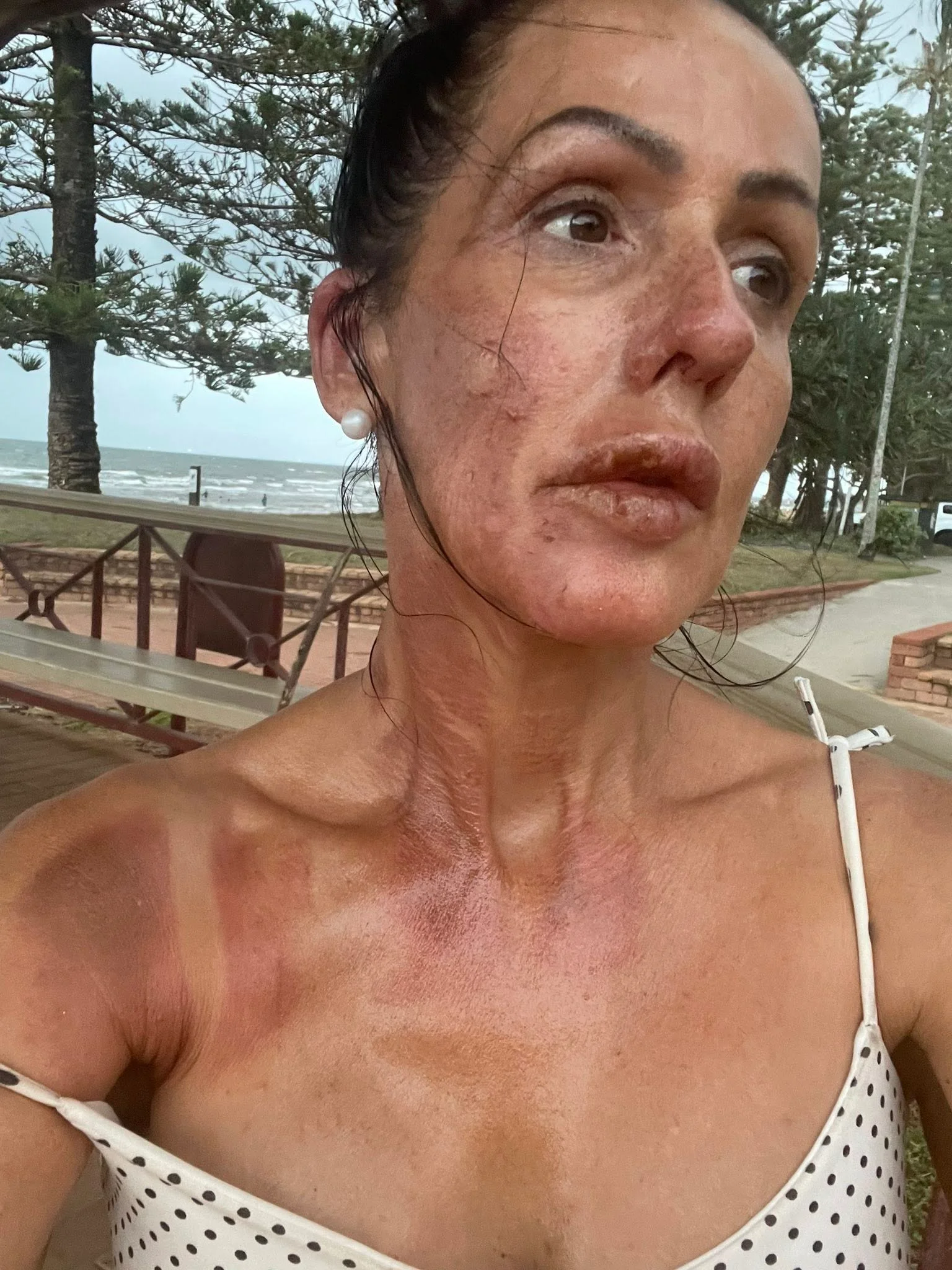 Redcliffe barbecue explosion